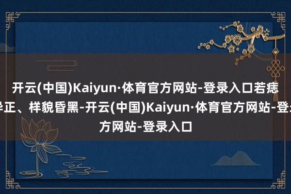 开云(中国)Kaiyun·体育官方网站-登录入口若痣形怪异正、样貌昏黑-开云(中国)Kaiyun·体育官方网站-登录入口